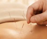 L'acupuncture efficace, même dans les services d'urgence…