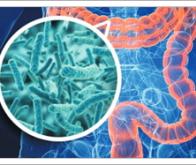 Le microbiote intestinal lié aux accidents vasculaires cérébraux