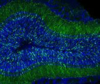 Le rôle des neurones nés chez l'adulte se précise