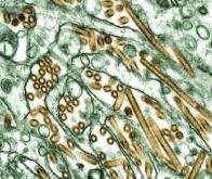 Le virus H5N1 est capable de s'adapter à l'homme 