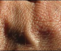 Les cellules de la peau, un indicateur de vieillissement en bonne santé