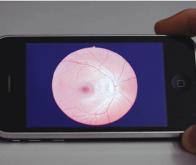 Les smartphones pourraient servir aux diagnostics oculaires