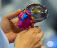 Les tumeurs rénales imprimées en 3D : un nouvel outil dans la lutte contre le cancer rénal