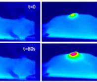 L'hyperthermie magnétique : un nouvel outil contre le cancer