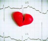 L'intelligence artificielle pour soigner les troubles du rythme cardiaque