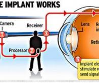 L'oeil bionique devient réalité