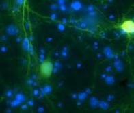 Maladie de Huntington et défauts de croissance des neurones