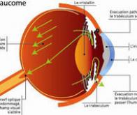 Mieux cibler les origines du glaucome pour préserver la vue