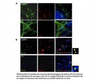 Mieux comprendre la schizophrènie grâce aux cellules-souches