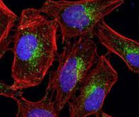 Mieux détecter les cellules-souches malignes