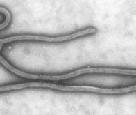 Mise au point d’un vaccin commun pour lutter contre la rage et Ebola 