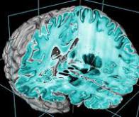 Modéliser l'activité du cerveau en 3D