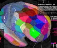 Notre cerveau retient plus facilement qu'il n'oublie