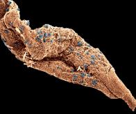 Paludisme : première étude complète du génome du parasite Plasmodium