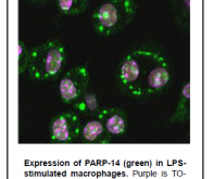 PARP14, une protéine contre le cancer