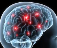 Plasticité cérébrale : il est possible de vivre avec la moitié du cerveau seulement