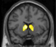 Prédire la fréquentation des réseaux sociaux grâce aux neurosciences !