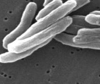 Prédire le développement d’une tuberculose en analysant l’ARN