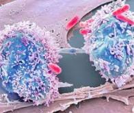 Premier essai au monde d’un virus anti-cancer chez l’homme