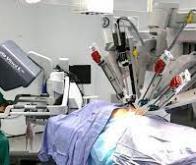 Première française en chirurgie pédiatrique robotique : une pyéloplastie chez un nourrisson de 5 ...