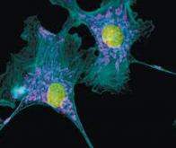 Prendre la tension cellulaire grâce à une molécule fluorescente
