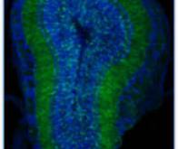 Produire de nouveaux neurones : un rêve qui pourrait devenir réalité