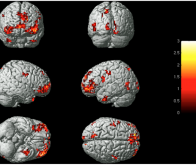 Quand l'activité de notre cerveau révèle nos émotions