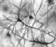 Régénérer le cerveau par des greffes de neurones : une nouvelle avancée