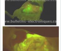 Rendre les cellules cancéreuses fluorescentes pour mieux les détecter