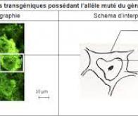 Sclérose latérale amyotrophique : une piste thérapeutique pour les formes les plus graves