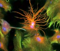 Stimuler la création de nouveaux neurones et prévenir la maladie d’Alzheimer