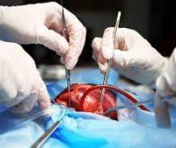 Transplantation cardiaque : une technologie innovante pour conserver plus longtemps le greffon