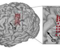 Un bras robotisé entièrement commandé par la pensée !
