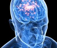 Un cerveau virtuel pour décrypter l'épilepsie