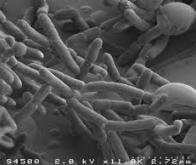 Un gène ignoré contrôle la régénération intestinale après une lésion