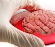 Un mini-cerveau artificiel présente les mêmes caractéristiques qu’un cerveau de bébé