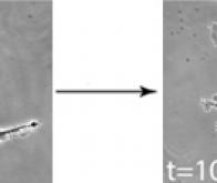Un nouveau levier d'action sur le cytosquelette pourrait révolutionner la biologie 