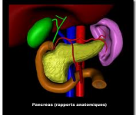 Un nouveau traitement contre le cancer du pancréas