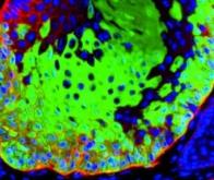 Un nouveau traitement moléculaire pour asphyxier les cellules cancéreuses