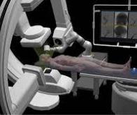 Un robot chirurgical  pour traiter à distance les victimes d’AVC