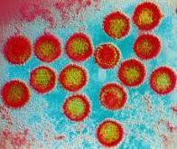 Un virus jouerait un rôle-clé dans l'apparition de la sclérose en plaques