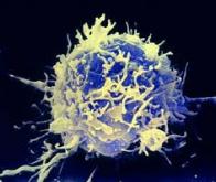Une approche innovante qui pourrait améliorer l’efficacité de l’immunothérapie du cancer