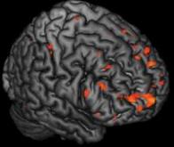 Une carte pour visualiser l’énergie dans le cerveau
