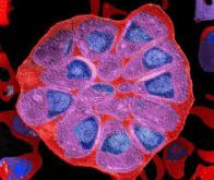 Une nouvelle classe de molécule contre les bactéries résistantes