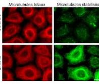 Une nouvelle molécule anticancéreuse très prometteuse !