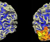 Une thérapie génique innovante pour redonner la vue à des patients atteints d’une maladie rare