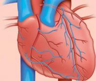 Vers un médicament qui réduit les dommages cellulaires après une crise cardiaque