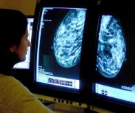 Vers une détection très précoce du cancer du sein