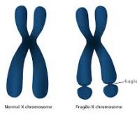 X FRAGILE : Une percée scientifique et thérapeutique