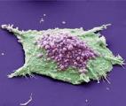 Affamer les cellules cancéreuses en bloquant leur métabolisme
